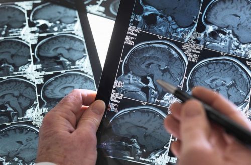 brain-1-gty-aa-200218_hpMain_4x3_992